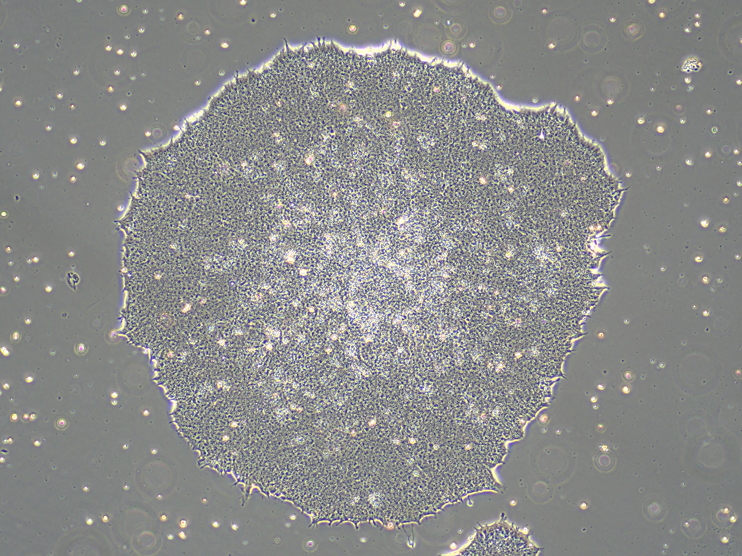 Photo de cellules IPSC indifférenciées x 4, Guillaume Cinquanta, IPMC
