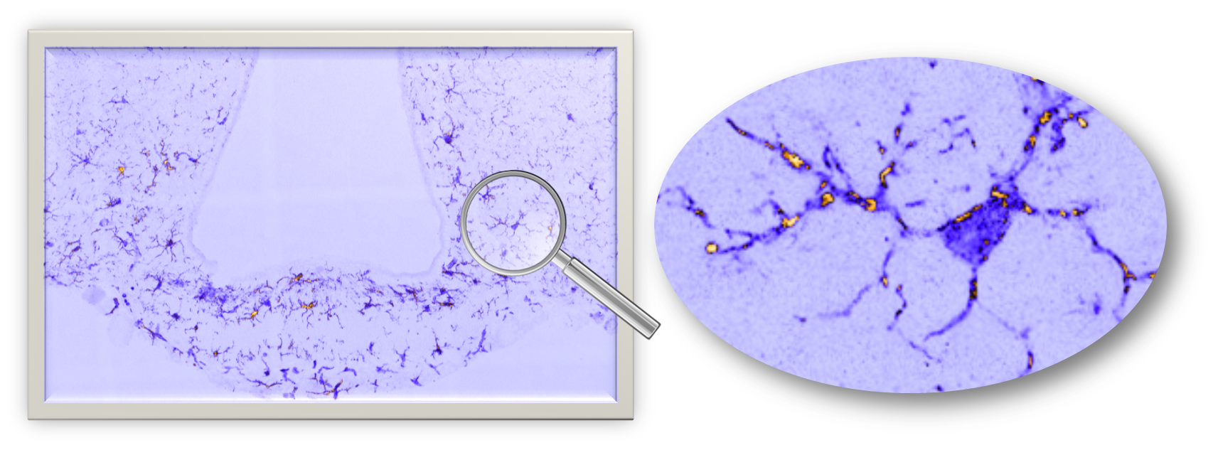 Microglial cells (in purple) in a brain slice from a mouse fed over 16 weeks with a butter-enriched diet. The zoom on hypothalamus shows the intense activation of the microglia, attested by their numerous branches and the formation of specific proteins (i